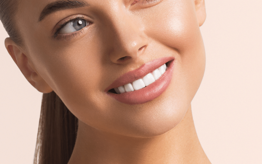 6 Things You Need to Know Before Getting Veneers