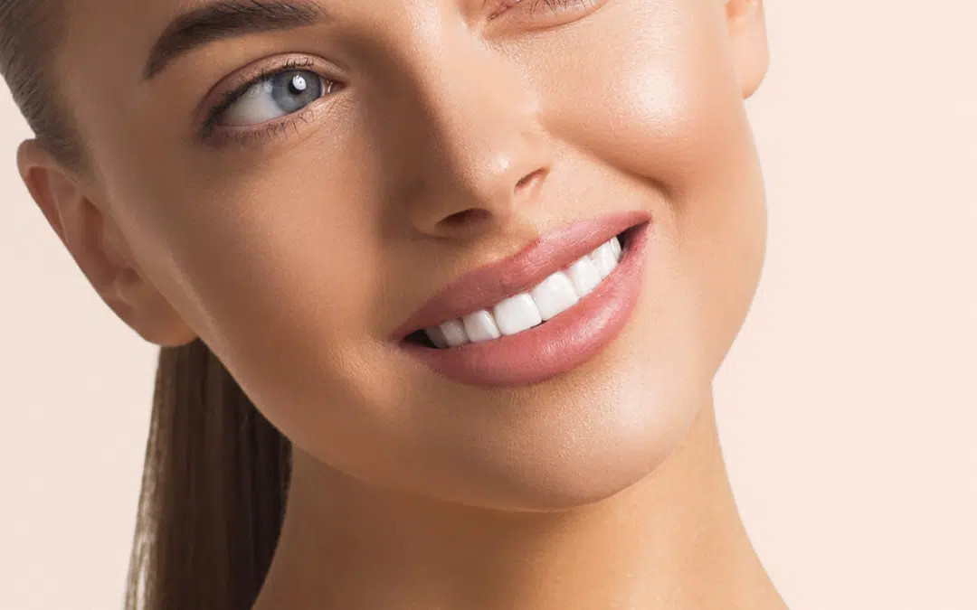 6 Things You Need to Know Before Getting Veneers