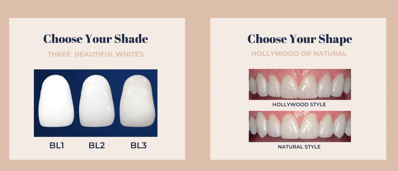 How to Choose the colour of your Veneers CosMediSmile Blog
