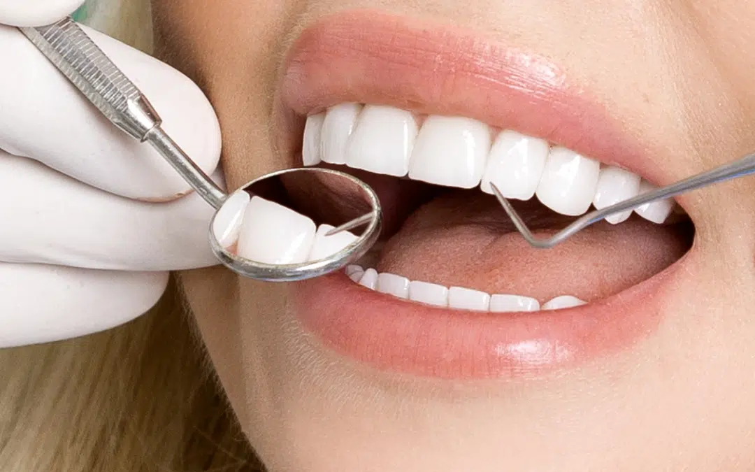 The Difference between a General and Cosmetic Dentist