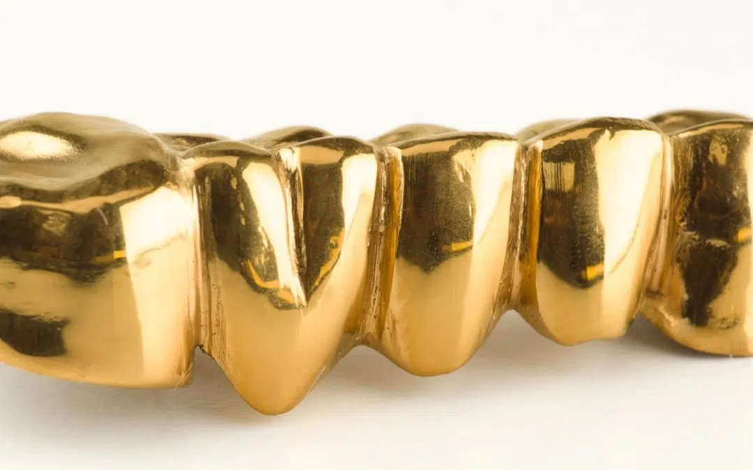 Gold Dental Crowns