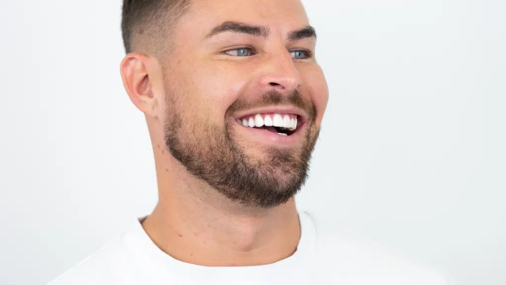 Man with Veneers in Gold Coast Australia