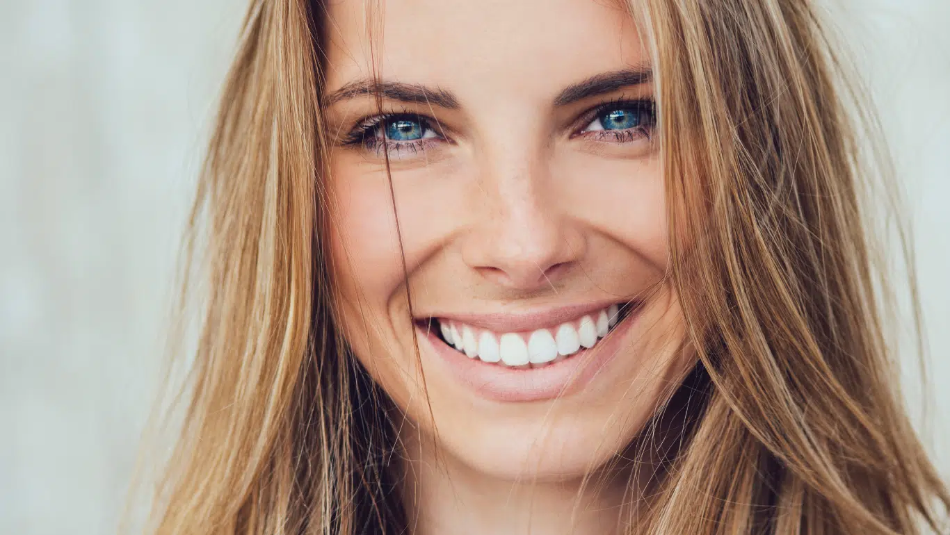 Woman with Veneers in Australia Gold Coast